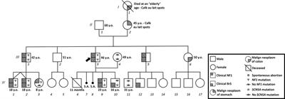 SCN5A Nonsense Mutation and NF1 Frameshift Mutation in a Family With Brugada Syndrome and Neurofibromatosis